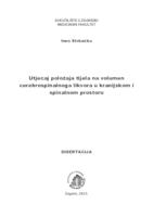 prikaz prve stranice dokumenta Utjecaj položaja tijela na volumen cerebrospinalnoga likvora u kranijskom i spinalnom prostoru